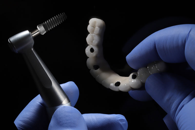 a full arch of teeth with 4 holes for placement onto the jaw and a dentist holding a tool to place it